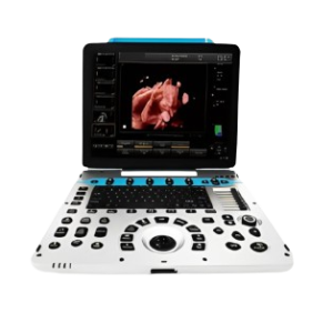 USG SONOMATE S21 LITE 4D HD