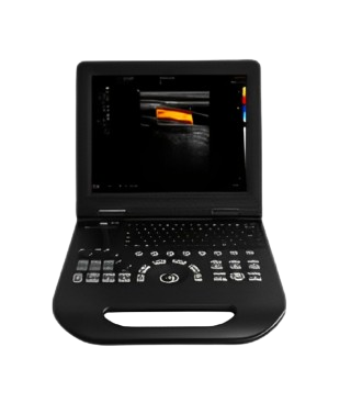 USG SONOMATE S30 COLOR DOPPLER